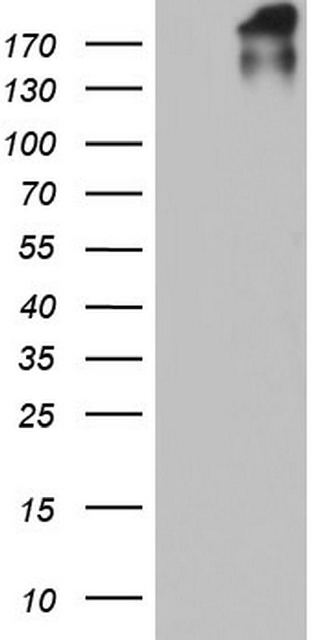 VWF Antibody in Western Blot (WB)