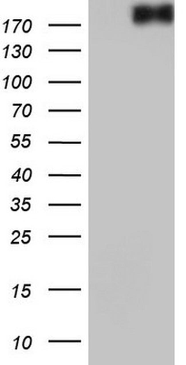 VWF Antibody in Western Blot (WB)