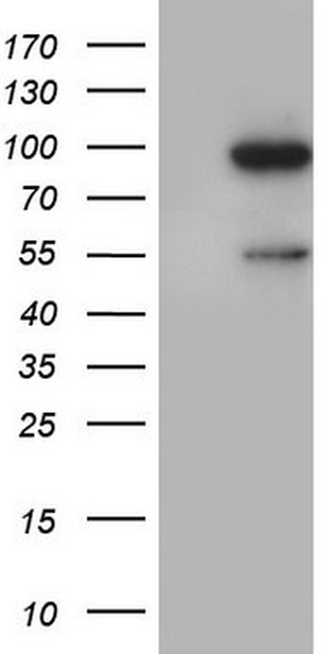 VWF Antibody in Western Blot (WB)