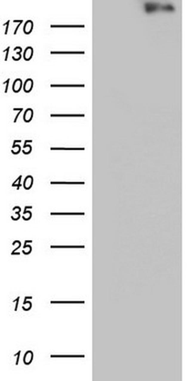 VWF Antibody in Western Blot (WB)