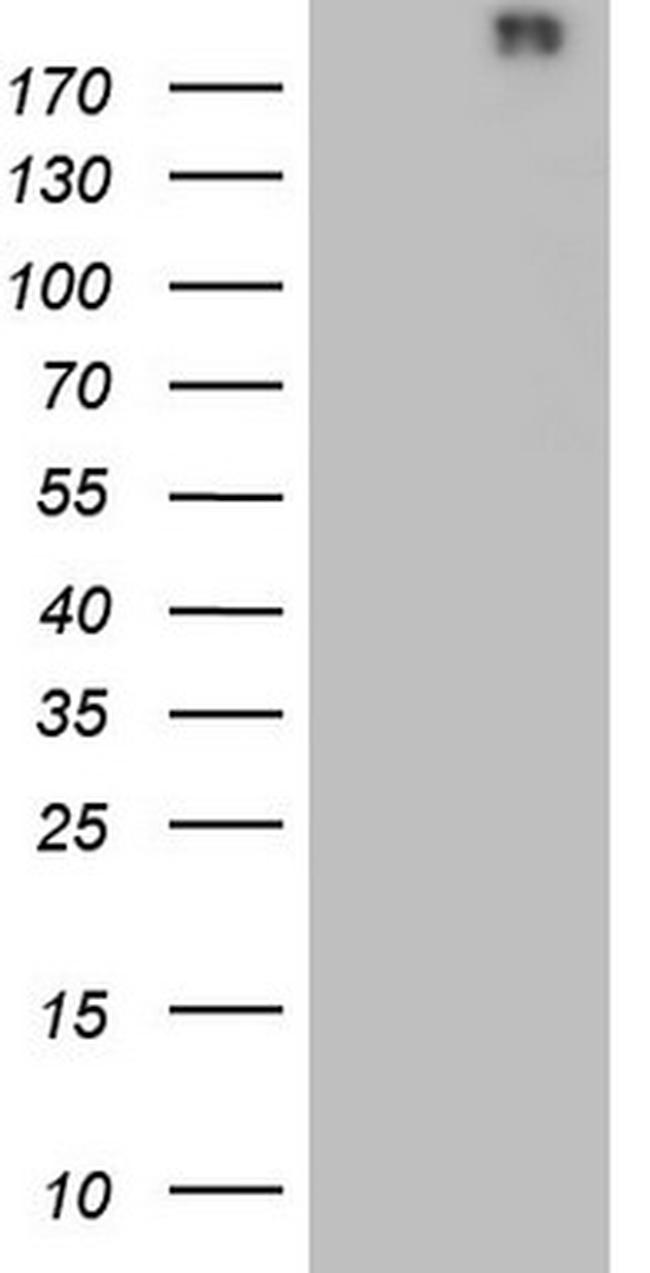 VWF Antibody in Western Blot (WB)