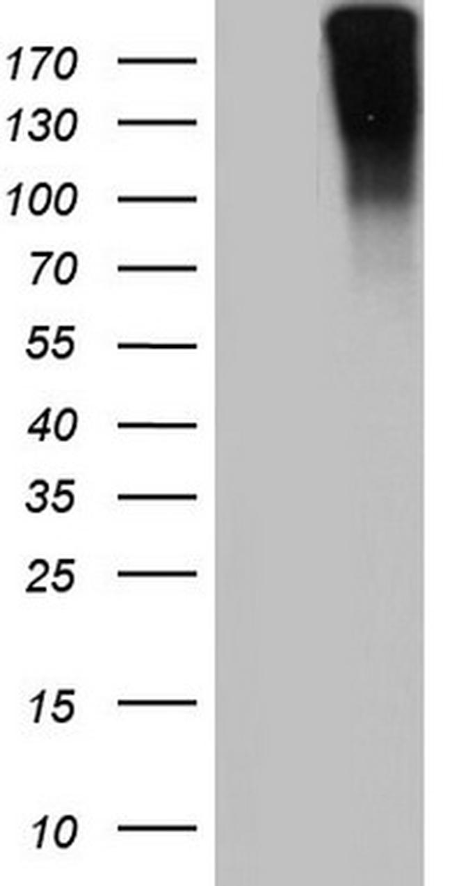 VWF Antibody in Western Blot (WB)