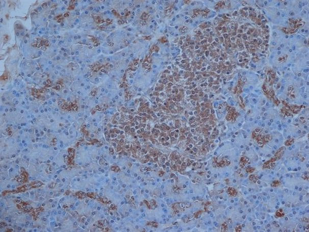 VIP Antibody in Immunohistochemistry (Paraffin) (IHC (P))