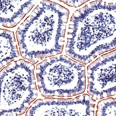 Villin Antibody in Immunohistochemistry (IHC)