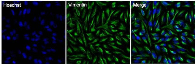 Vimentin Antibody in Immunocytochemistry (ICC/IF)