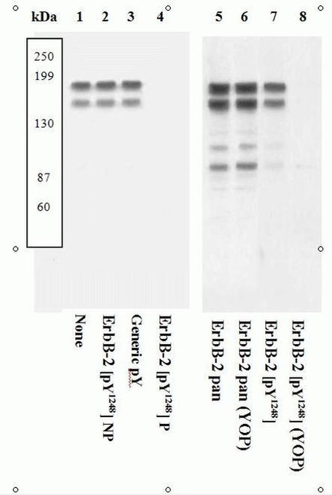 Phospho-ErbB2 (HER-2) (Tyr1248) Antibody in Western Blot (WB)