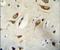 WBP2 Antibody in Immunohistochemistry (IHC)