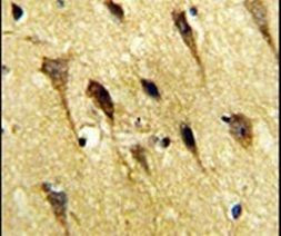 WBP2 Antibody in Immunohistochemistry (IHC)