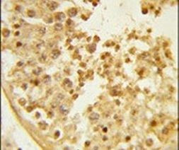 WDR37 Antibody in Immunohistochemistry (IHC)