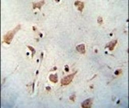 WDR48 Antibody in Immunohistochemistry (IHC)