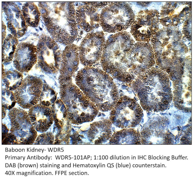 WDR5 Antibody in Immunohistochemistry (IHC)