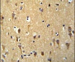 WDR73 Antibody in Immunohistochemistry (IHC)