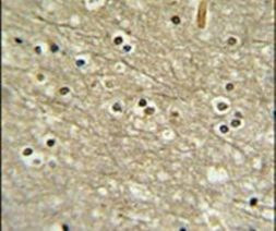 WDR82 Antibody in Immunohistochemistry (IHC)