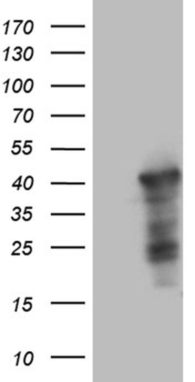 WDR92 Antibody in Western Blot (WB)