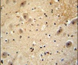 WDSOF1 Antibody in Immunohistochemistry (IHC)