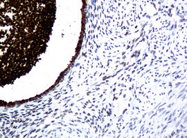 WFDC2 Antibody in Immunohistochemistry (Paraffin) (IHC (P))
