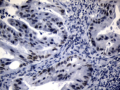 WHSC1L1 Antibody in Immunohistochemistry (Paraffin) (IHC (P))
