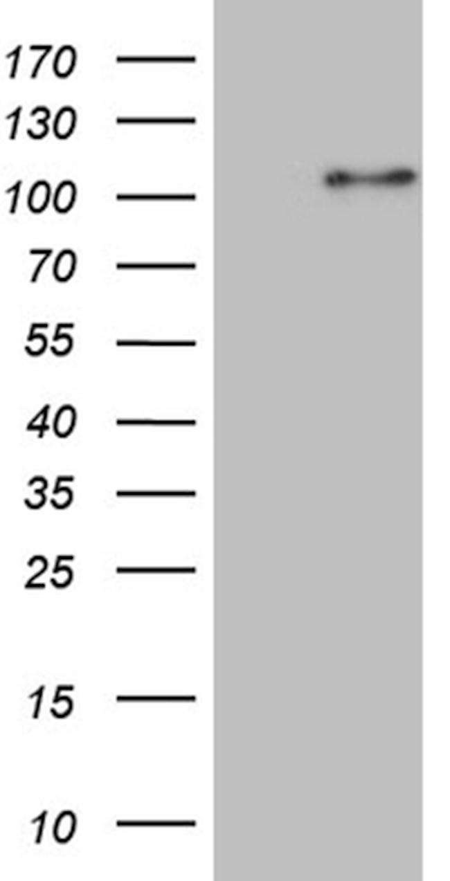 WHSC1L1 Antibody in Western Blot (WB)