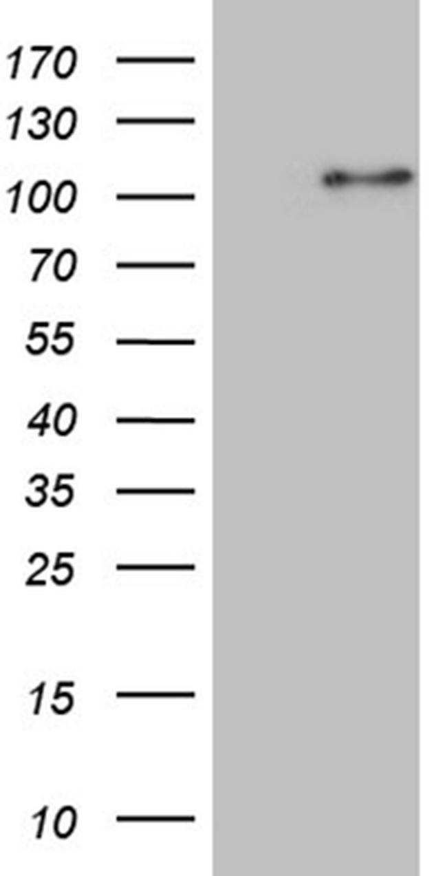 WHSC1L1 Antibody in Western Blot (WB)