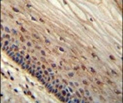 WIBG Antibody in Immunohistochemistry (IHC)