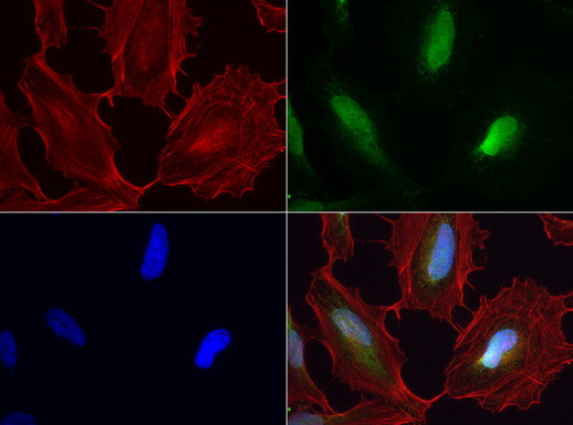 WIBG Antibody in Immunocytochemistry (ICC/IF)
