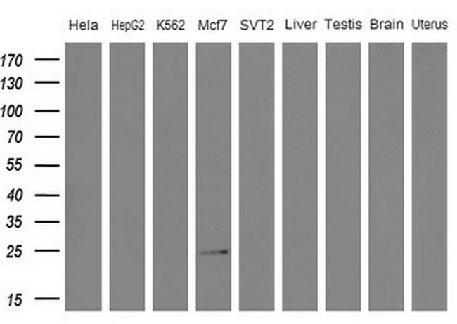 WIBG Antibody in Western Blot (WB)