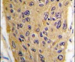 WIF1 Antibody in Immunohistochemistry (IHC)