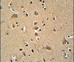 WIPF2 Antibody in Immunohistochemistry (IHC)