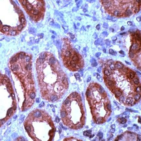 WNT1 Antibody in Immunohistochemistry (IHC)