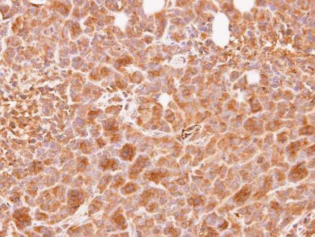 WNT10B Antibody in Immunohistochemistry (IHC)