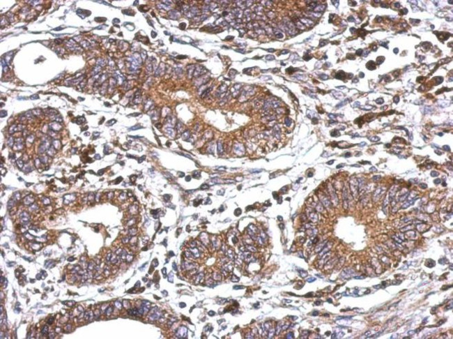 WNT6 Antibody in Immunohistochemistry (IHC)