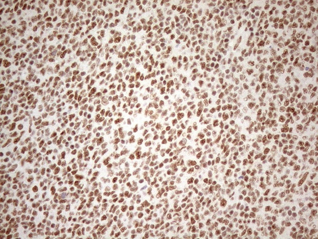 WTAP Antibody in Immunohistochemistry (Paraffin) (IHC (P))