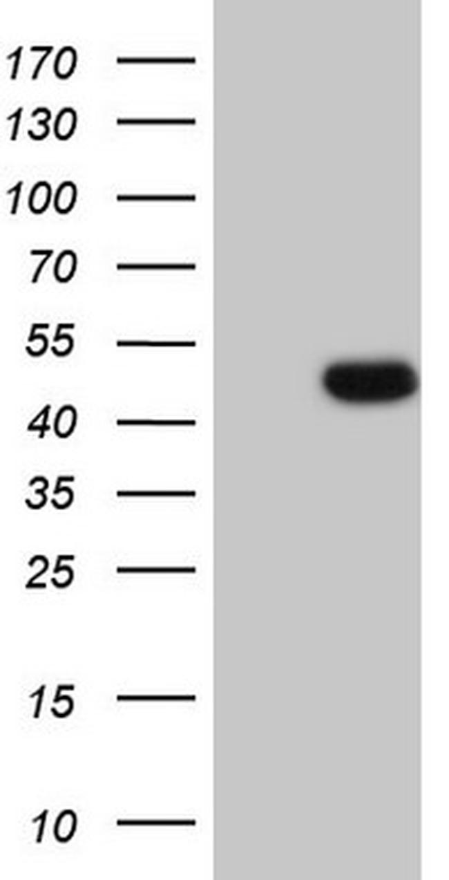 WTAP Antibody in Western Blot (WB)