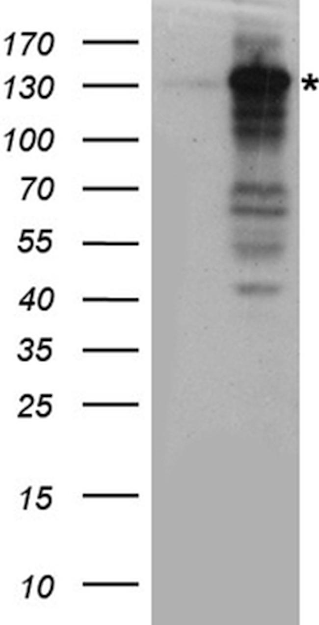 XPC Antibody in Western Blot (WB)