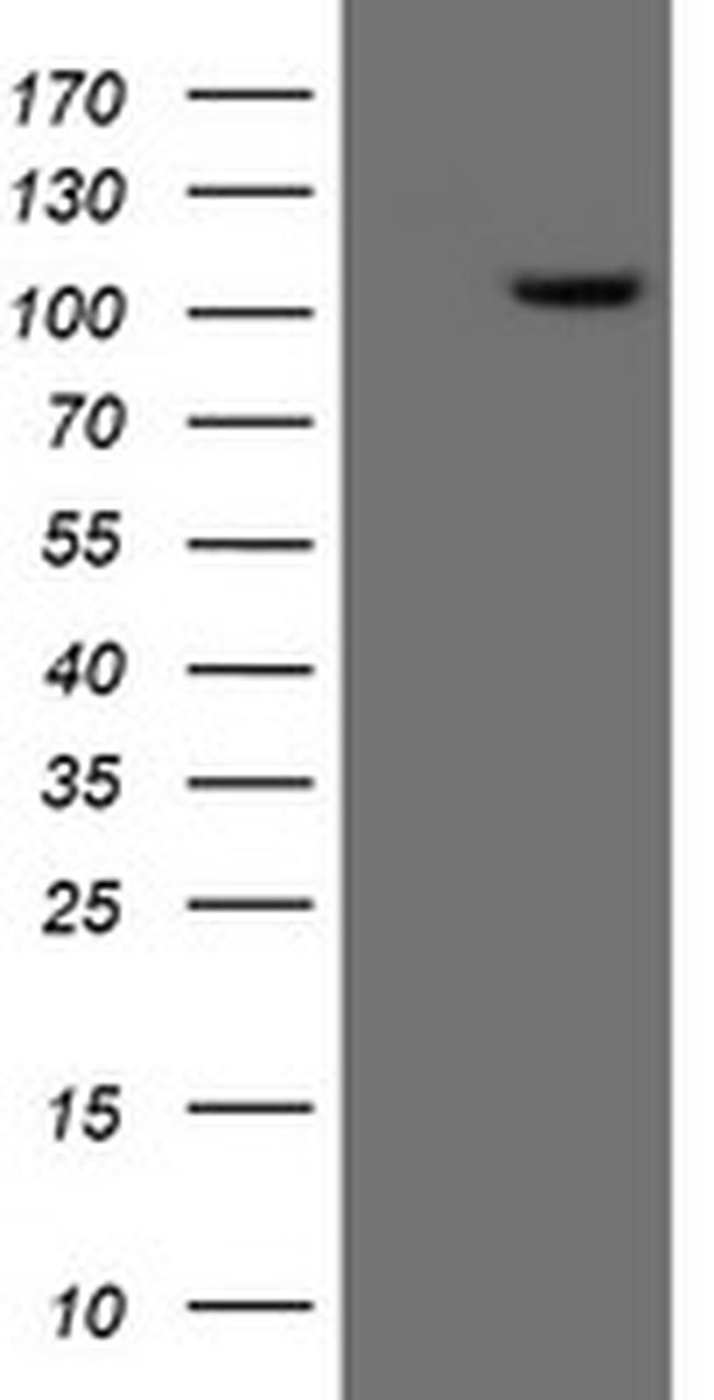 XPF Antibody in Western Blot (WB)
