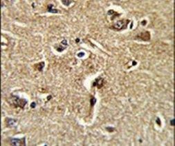 XPOT Antibody in Immunohistochemistry (IHC)