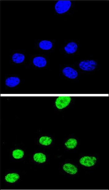 XRCC1 Antibody in Immunocytochemistry (ICC/IF)