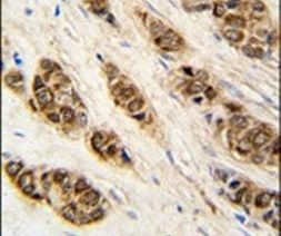 XTP3TPA Antibody in Immunohistochemistry (IHC)