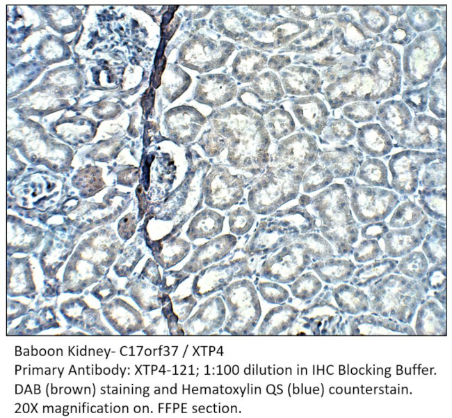 C17orf37/XTP4 Antibody in Immunohistochemistry (IHC)