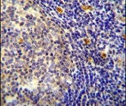 YDJC Antibody in Immunohistochemistry (IHC)