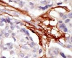 YES1 Antibody in Immunohistochemistry (IHC)