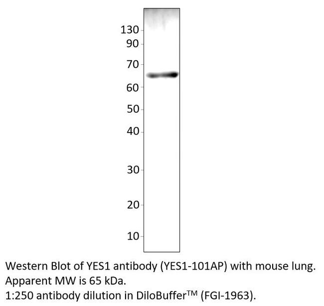 YES1 Antibody in Western Blot (WB)