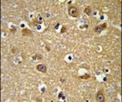 YIPF5 Antibody in Immunohistochemistry (IHC)
