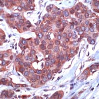 14-3-3 zeta Antibody in Immunohistochemistry (IHC)
