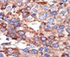 YY1 Antibody in Immunohistochemistry (IHC)