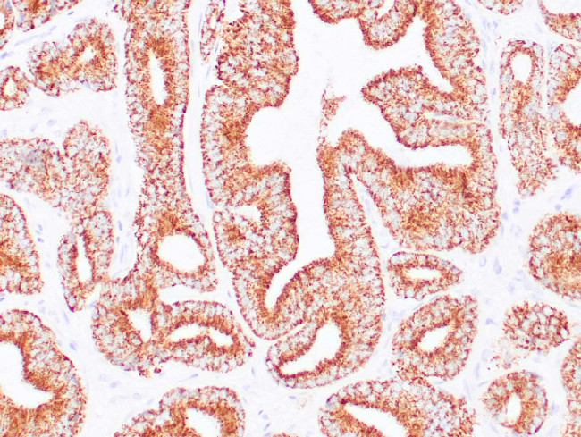 AMACR Antibody in Immunohistochemistry (Paraffin) (IHC (P))