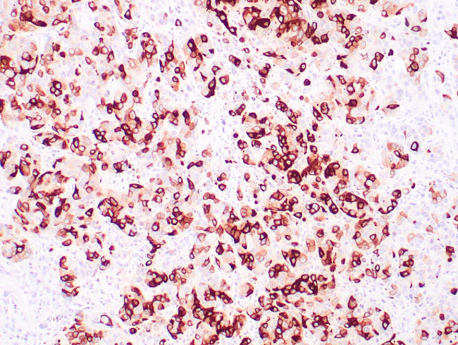Mammaglobin A Antibody in Immunohistochemistry (Paraffin) (IHC (P))