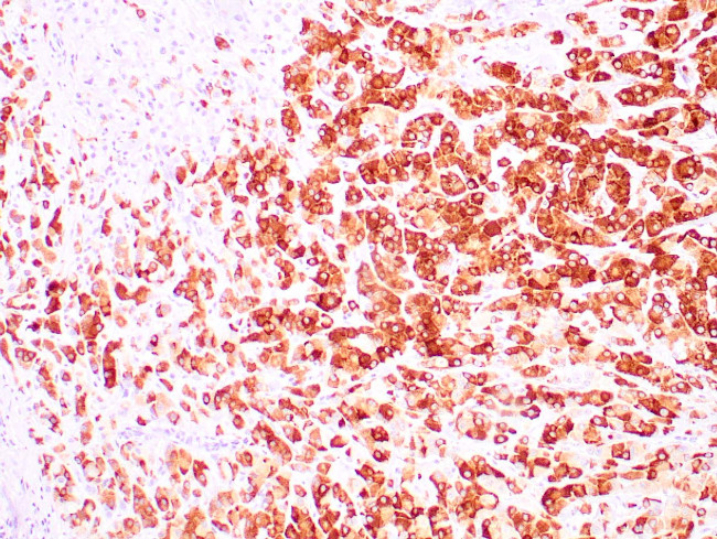 Mammaglobin A Antibody in Immunohistochemistry (Paraffin) (IHC (P))
