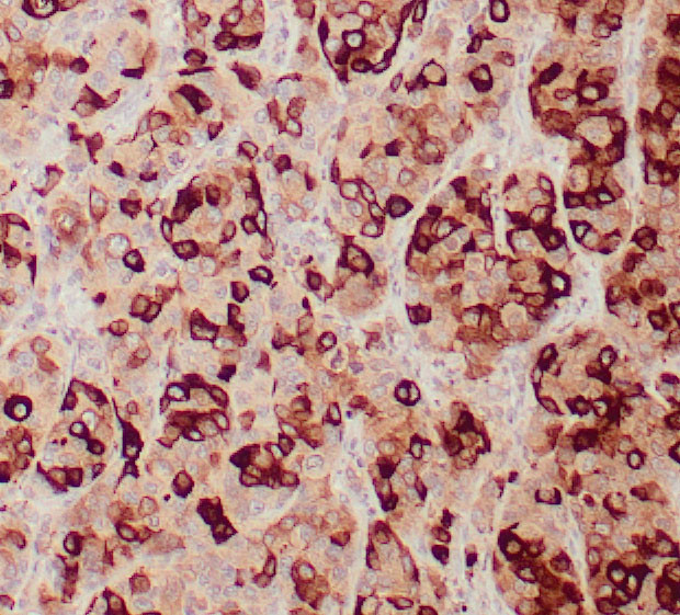 Mammaglobin A Antibody in Immunohistochemistry (Paraffin) (IHC (P))
