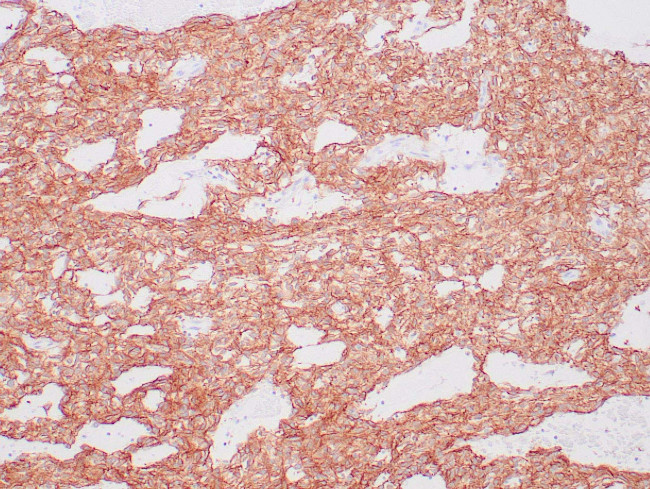 DOG-1 Antibody in Immunohistochemistry (Paraffin) (IHC (P))